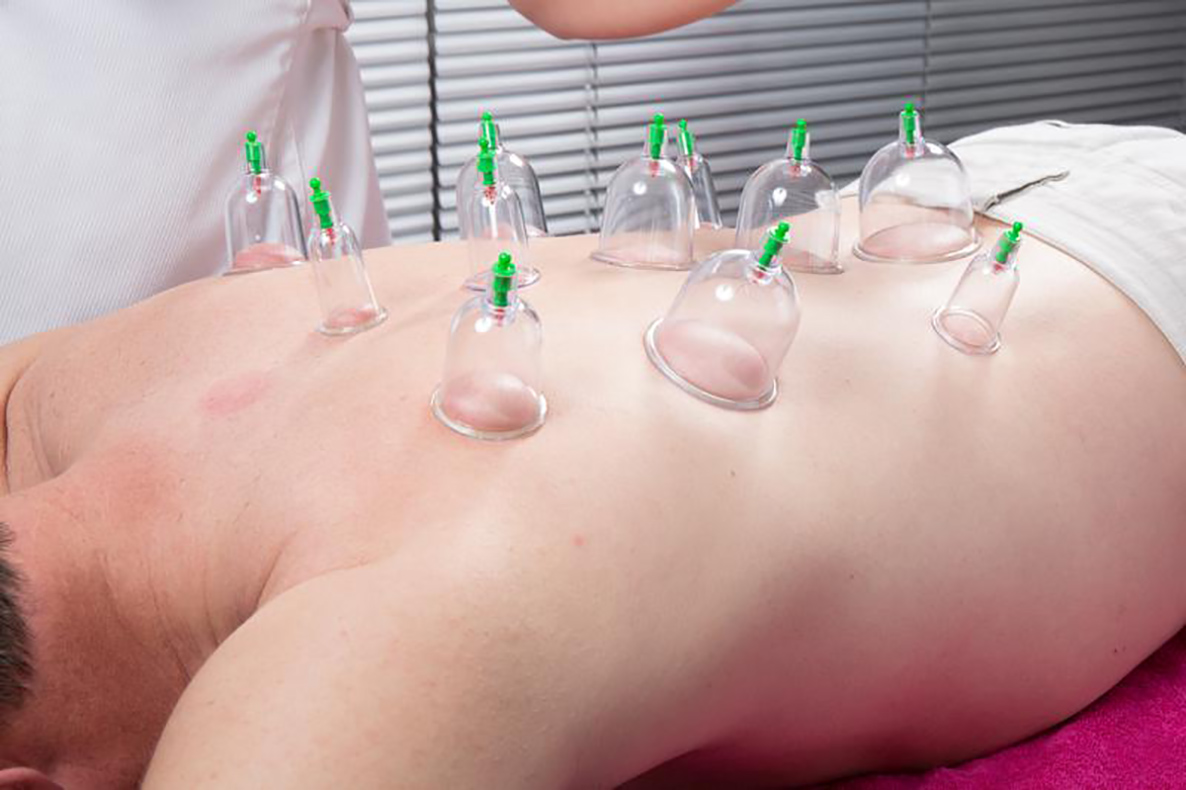 Introduction Of Hijama – D2D Therapies Ltd. in london